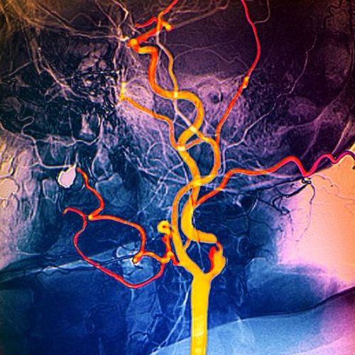 Kombinált ultrahang csomag: hasi és kismedencei, plusz nyaki komplex (pajzsmirigy, nyálmirigyek és nyaki lágyrészek)