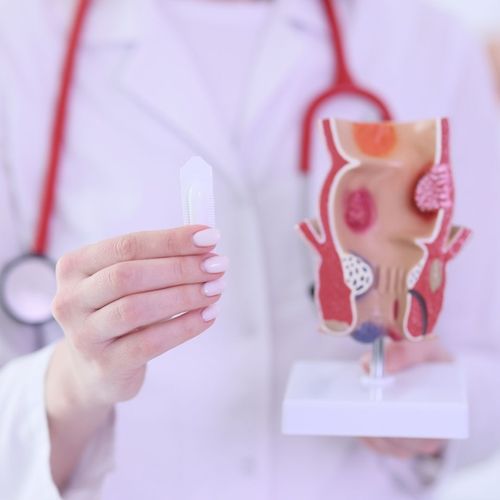 Proktológiai vizsgálat kisműtéttel! Aranyérpanaszok orvoslására és végbélrák megelőző állapotok szűrésére