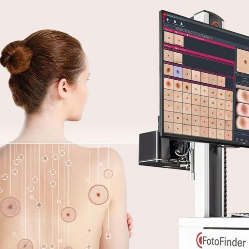 Precíz anyajegyszűrés korszerű technológiával – FotoFinder AI + komplett testtérképezés a Visegrádi40-nél