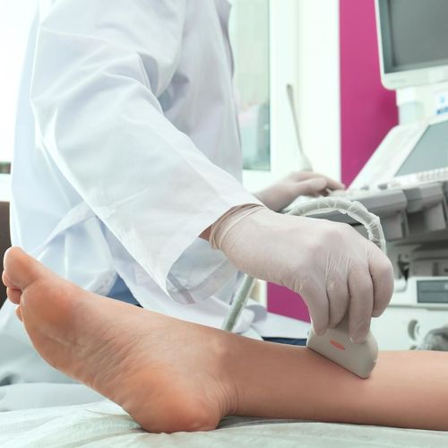 Doppler Ultrahangos Ervizsgalat