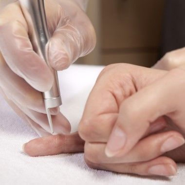 Szabadulj meg a kellemetlen bőrproblémától: 1-2 szemölcs eltávolítása elektrokoagulátorral, teljesen fájdalommentesen! (intimzónáról is)